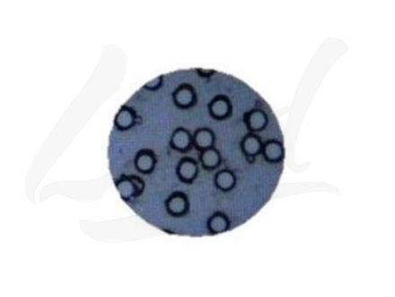 膀胱癌液基新技術簡介