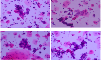 聚焦膜科技創新應用，「鄰得膜醫療」拓展膀胱癌早篩產品